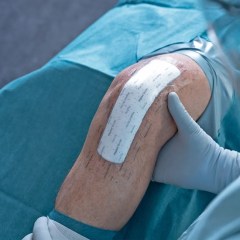 Mepilex Border PostOp silik.obloga OMC (1)